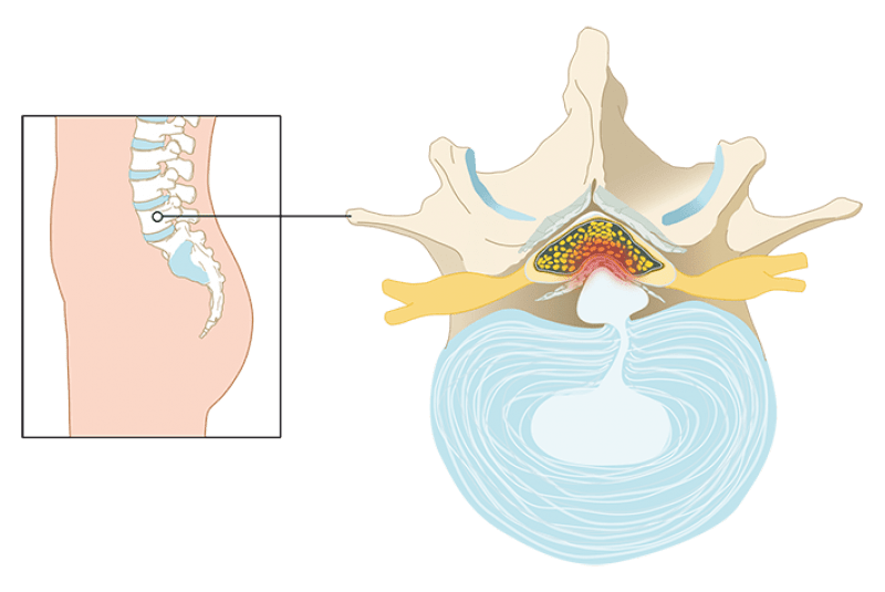 fig 1a