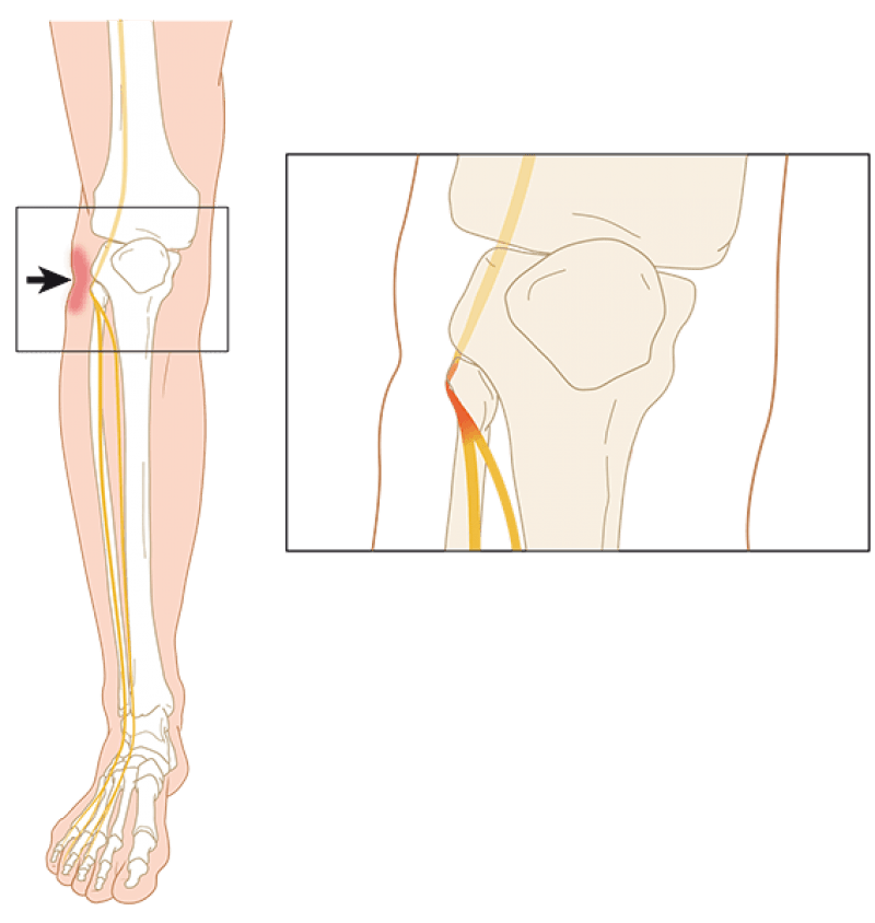 fig 1b